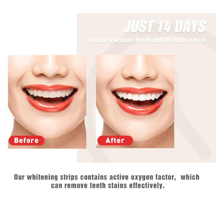 gentle whitening strips price for wholesale for home usage