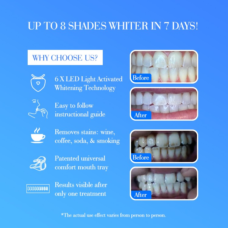 GlorySmile Wholesale high quality led teeth whitening home kit Suppliers for teeth-5