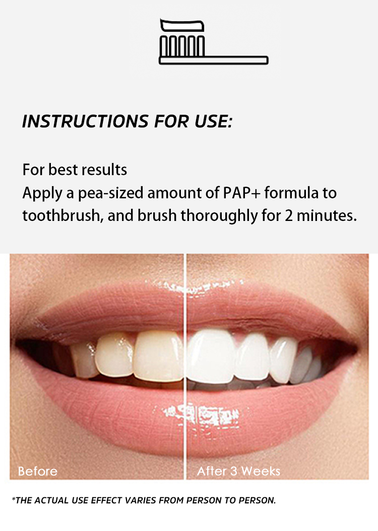 Custom high quality pap teeth whitening gel manufacturers for teeth-6