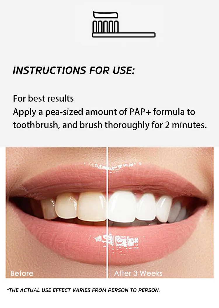 GlorySmile Bulk buy custom pap formula teeth whitening for business for whitening teeth