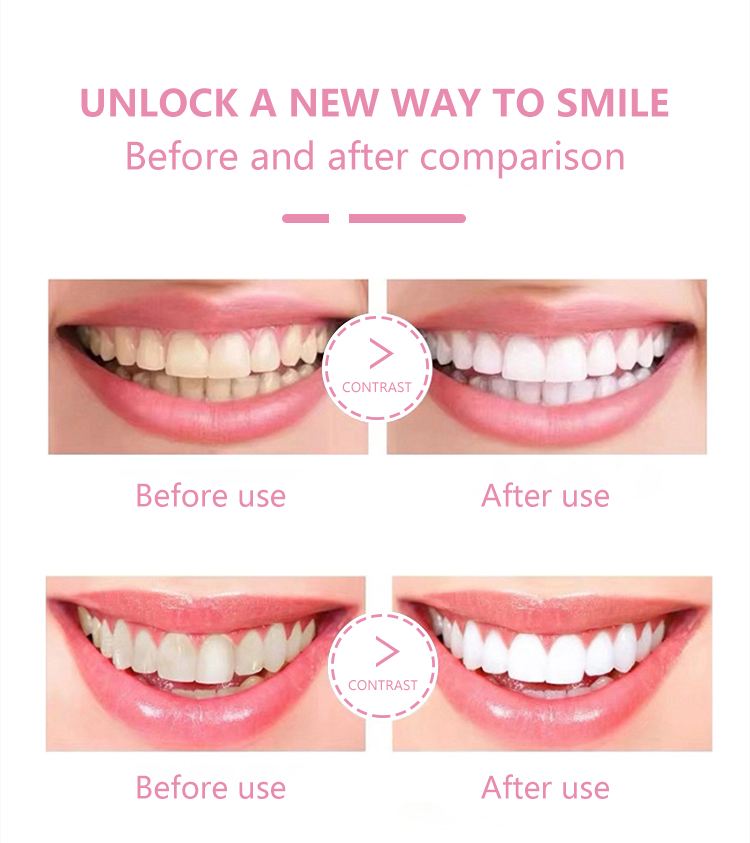 GlorySmile OEM smiles teeth whitening powder manufacturers for dental bright-7