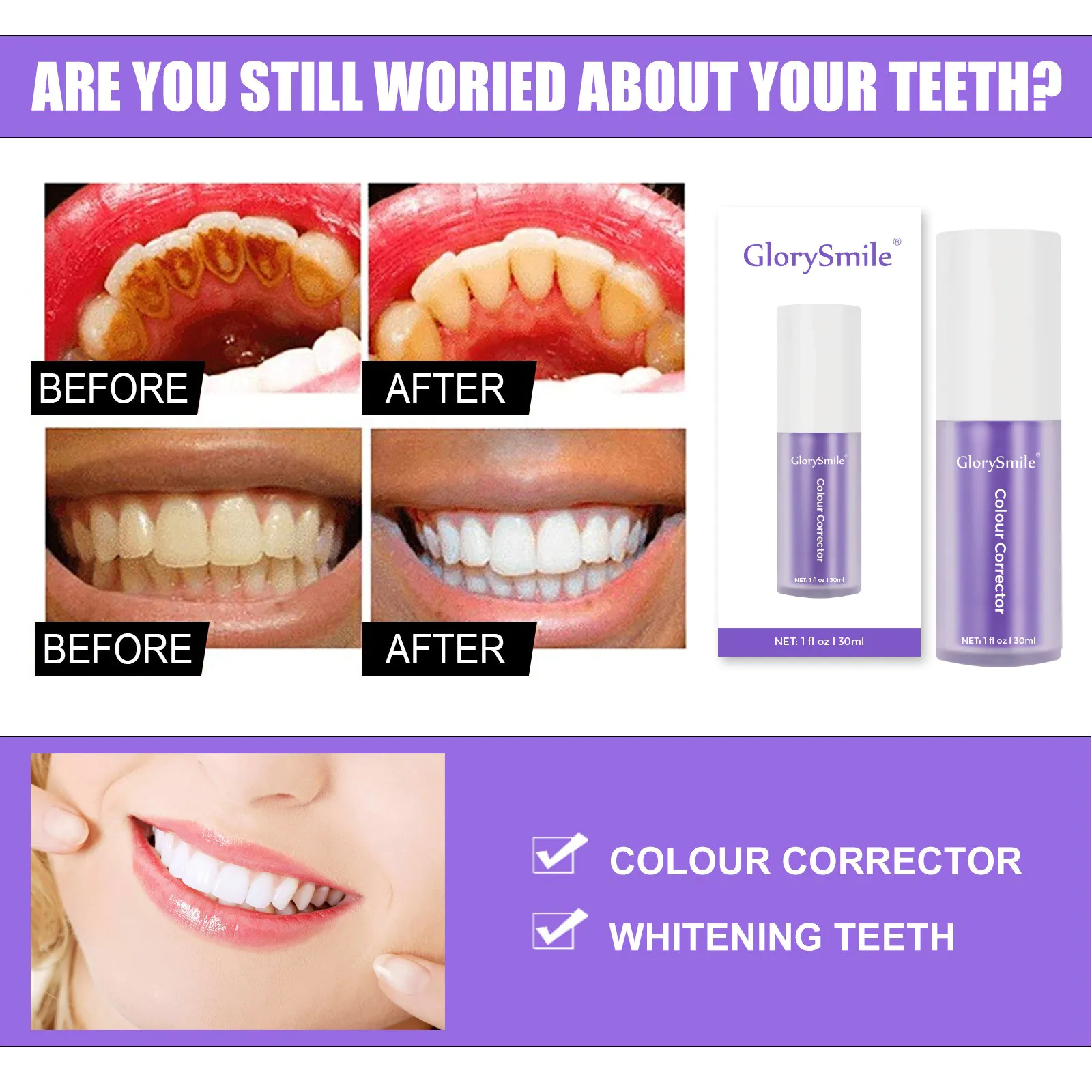 Latest V34 Colour Corrector Suppliers for whitening teeth