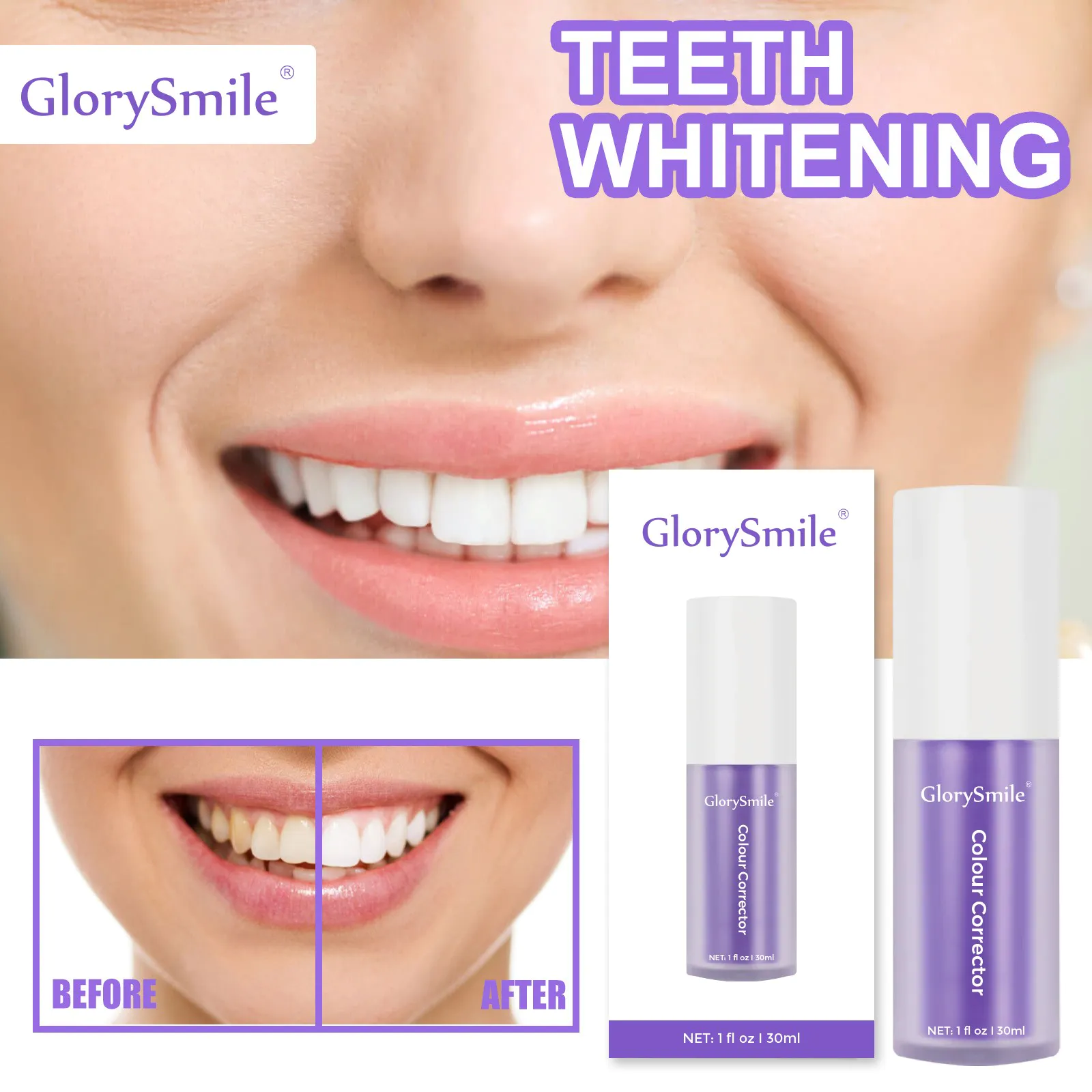 GlorySmile teeth whitening mousse company for home usage