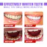 Bulk buy ODM mousse teeth whitening Suppliers for home usage