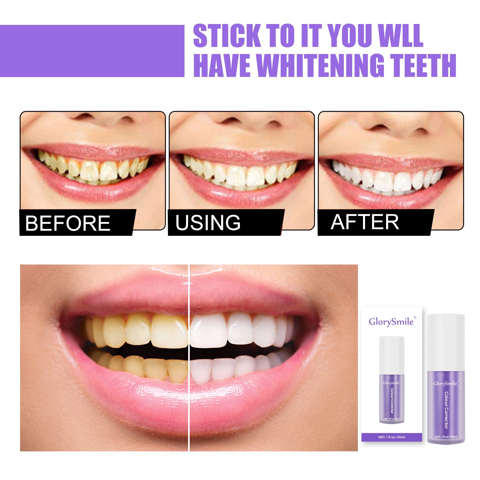 GlorySmile New mousse foam teeth whitening inquire now for whitening teeth-6