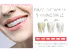 Bulk purchase custom dental white strips manufacturers for teeth