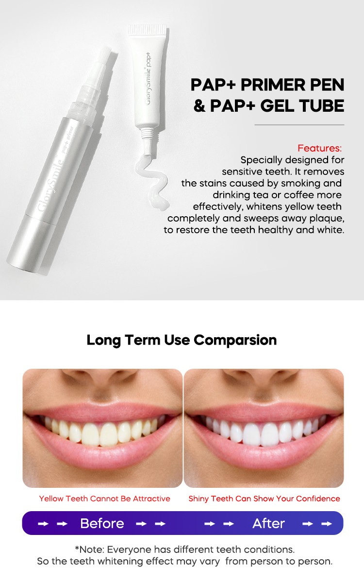 Bulk purchase OEM led home teeth whitening kit wholesale for teeth-4