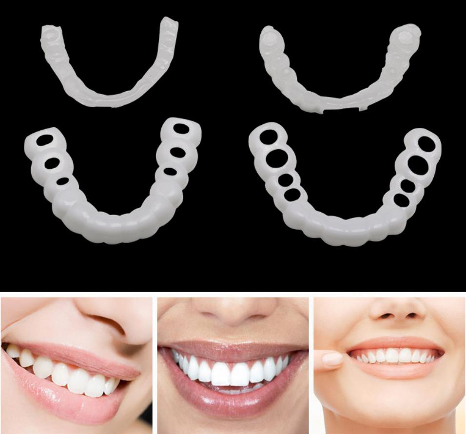 GlorySmile custom made teeth whitening trays Supply-3