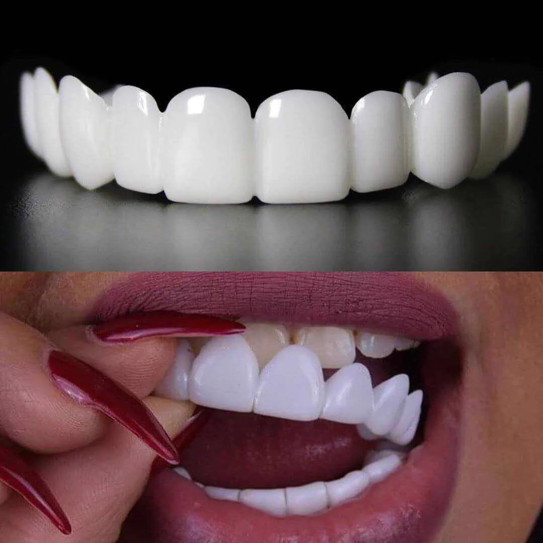 GlorySmile custom made teeth whitening trays Supply