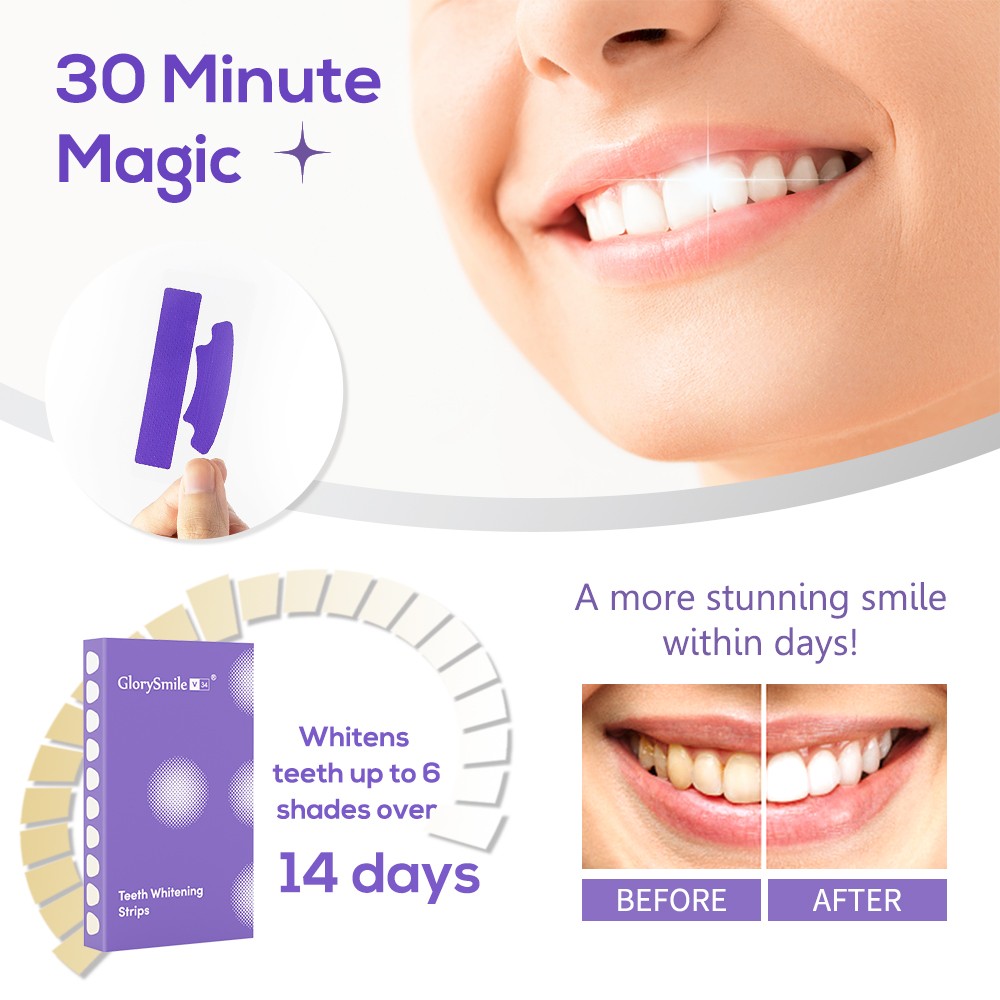 GlorySmile teeth bleaching strips for wholesale for teeth-3