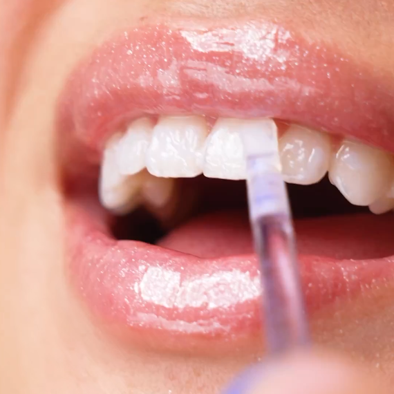 GlorySmile BPA free teeth whitening brush pen factory price for teeth-2