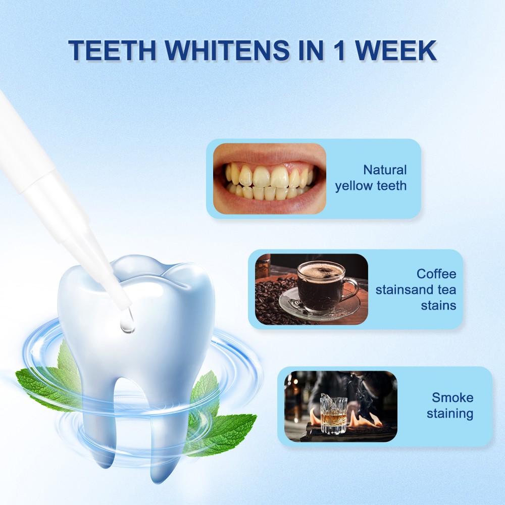 GlorySmile dentist teeth whitening kit company for teeth-6